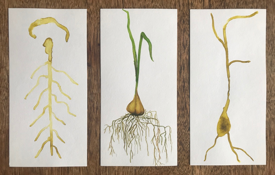 triptych of watercolors of the spleen in yellow, garlic with its root system, and the cisterna chyli in yellow